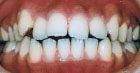 歯の色確認の様子
